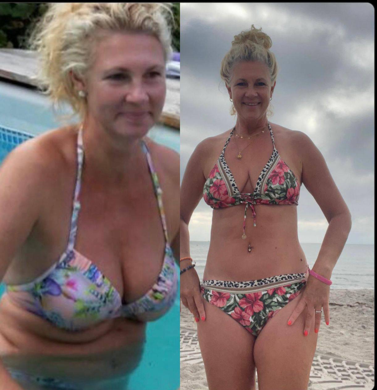 Kerstin vorher und nachher